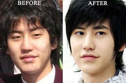 Известные корейские актеры до и после пластики